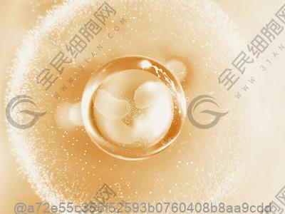 女性甲亢是什么原因引起是